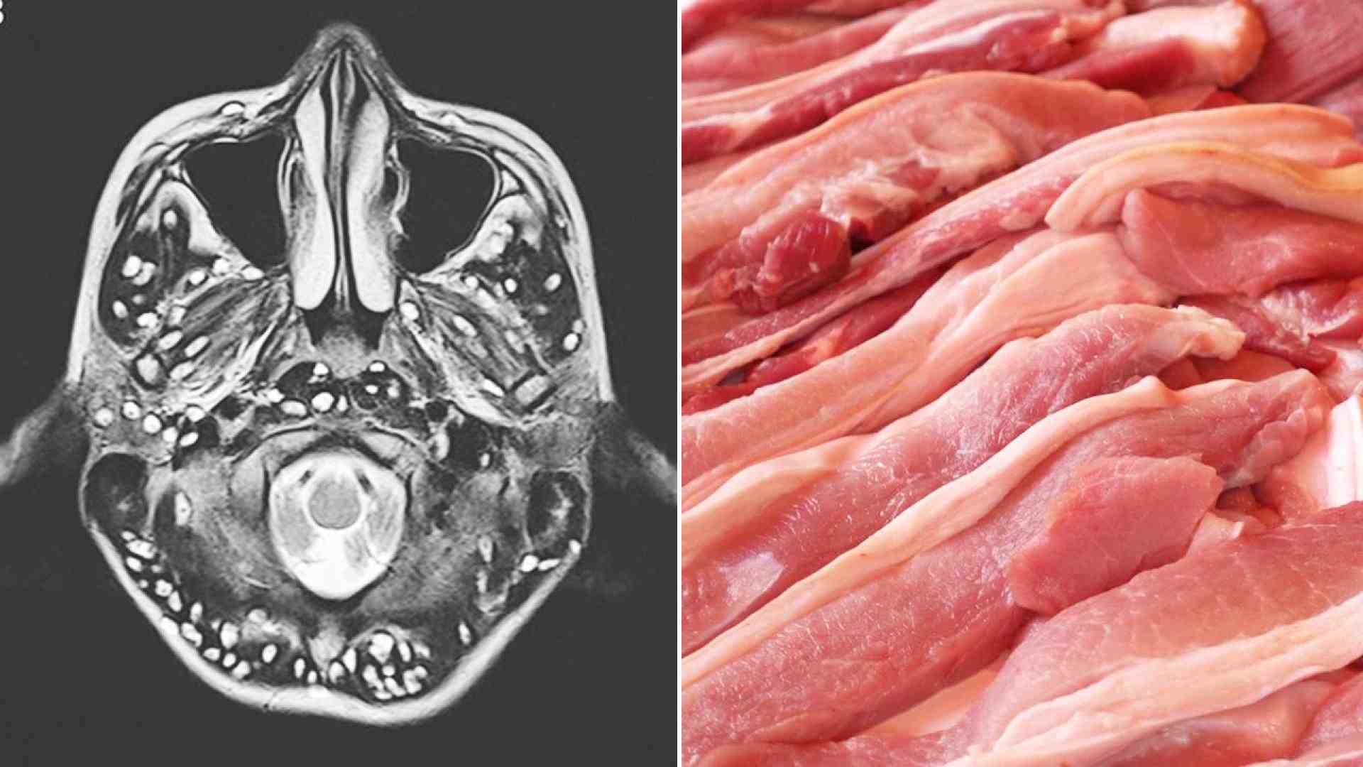 Can pork be medium rare?